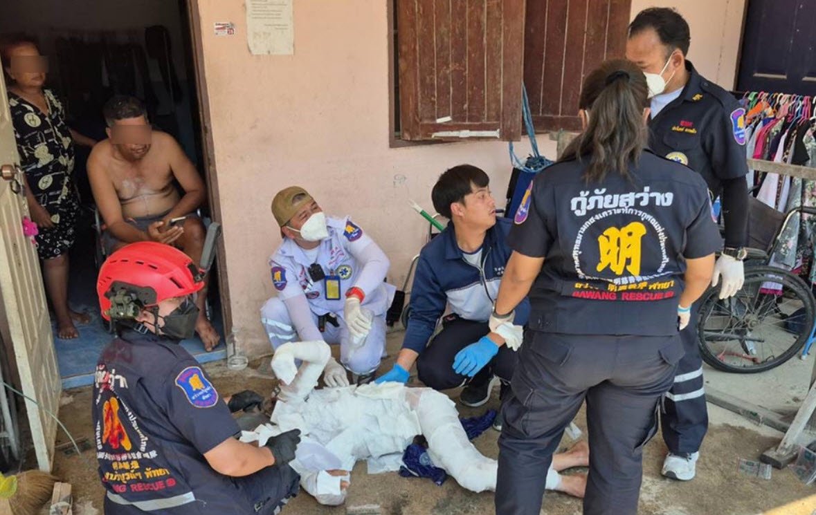 Pattaya Man Suffers Severe Burns After Attempting Self-Immolation Over Unrequited Love